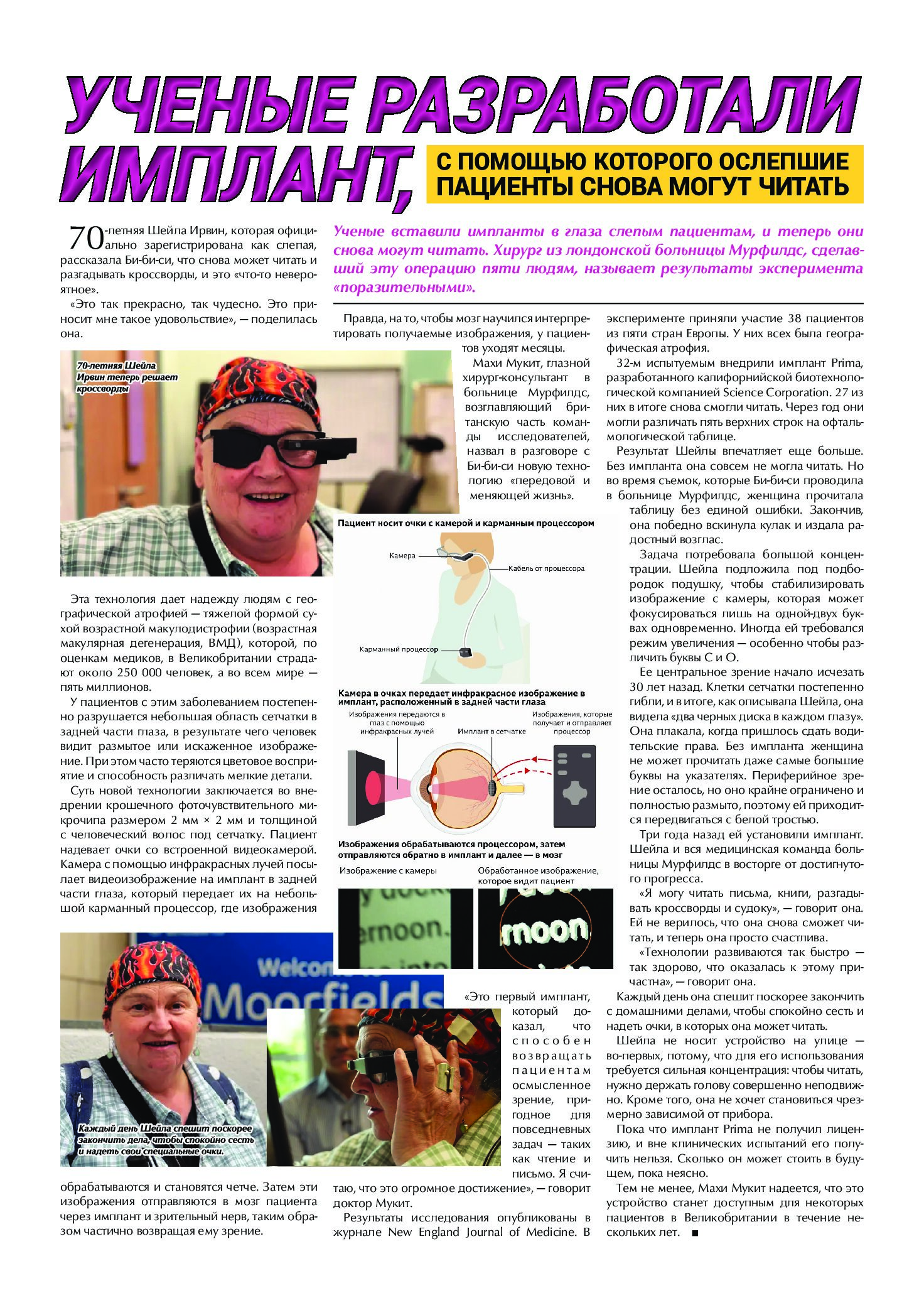 Implant_article (1)